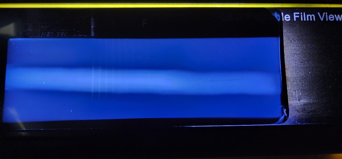 Filme radiográfico no negatoscópio LED com indicação de falta de fusão na solda